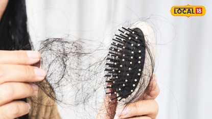 प्रतिकात्मक फोटो प्रतिकात्मक फोटो