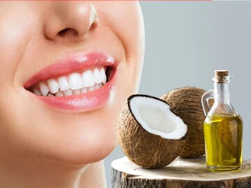 या ट्रिकने नैसर्गितरित्या चमकतील दात या ट्रिकने नैसर्गितरित्या चमकतील दात