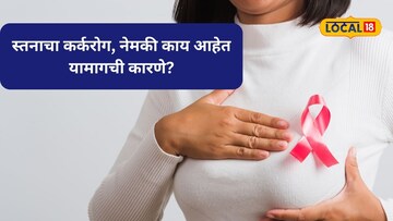 स्तनाचा