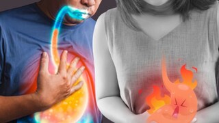 Acidity चा त्रास कमी करायचा आहे? मग करा ‘हे’ उपाय Acidity चा त्रास कमी करायचा आहे? मग करा ‘हे’ उपाय