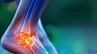 Uric Acid Home Remedies: ‘या’ चहाने युरिक ॲसिड येईल नियंत्रणात; घरच्या घरी करा 'हा' साधा सोपा उपाय Uric Acid Home Remedies: ‘या’ चहाने युरिक ॲसिड येईल नियंत्रणात; घरच्या घरी करा 'हा' साधा सोपा उपाय