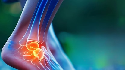 Uric Acid Home Remedies: ‘या’ चहाने युरिक ॲसिड येईल नियंत्रणात; घरच्या घरी करा 'हा' साधा सोपा उपाय Uric Acid Home Remedies: ‘या’ चहाने युरिक ॲसिड येईल नियंत्रणात; घरच्या घरी करा 'हा' साधा सोपा उपाय