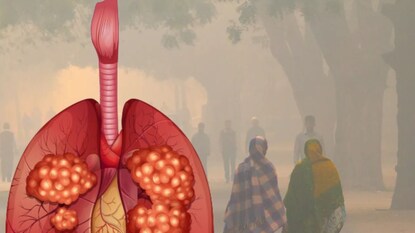सावधान! प्रदूषण ठरतंय जीवघेणं ; स्मोकिंग न करताही होतोय कॅन्सर