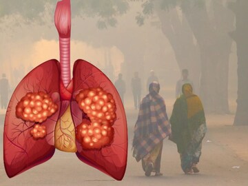 सावधान! प्रदूषण ठरतंय जीवघेणं ; स्मोकिंग न करताही होतोय कॅन्सर