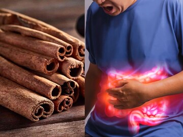 benefits of cinnamon एवढ्याशा दालचिनीचे आहेत ‘इतके’ फायदे  माहिती तरी आहेत का ?