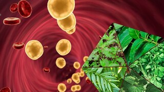 प्रतिकात्मक फोटो : कोलेस्टेरॉलच्या त्रासावर गुणकारी आहेत ‘ही’ पानं