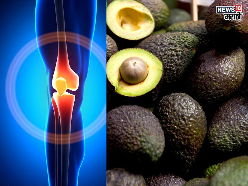 ॲवाकॅडोमध्ये कॅल्शियम मुबलक प्रमाणात आढळते, त्यामुळे ॲवाकॅडोच्या नियमित सेवनाने हाडांचा ठिसूळपणा दूर होऊन हाडं मजबूत होतात. ॲवाकॅडोच्या दाहक विरोधी गुणधर्मांमुळे सांधेदुखीवरही ते परिणामकारक ठरतं. 
