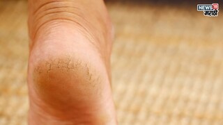 प्रतिकात्मक फोटो : हिवाळ्यात पायांना भेगा पडतात? वापरा ‘या’ सोप्या टिप्स आणि घ्या पायांची काळजी