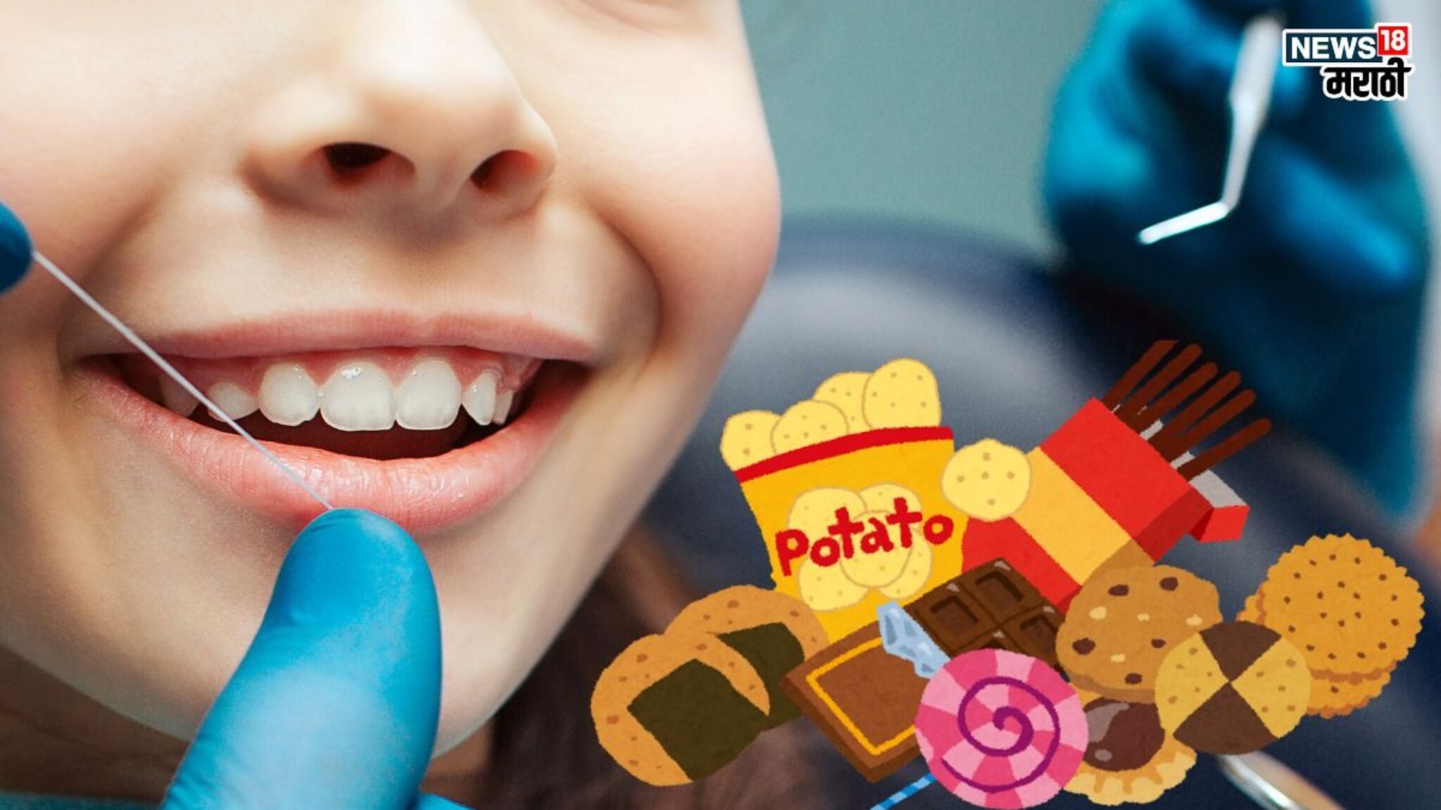 Buck teeth & Junk Food: ऐकावं ते नवलंच! चॉकलेट, चिप्स खाल्याने मुलांचे दात पुढे येतात, जबड्याची बिघडते ठेवण आणि आकार
