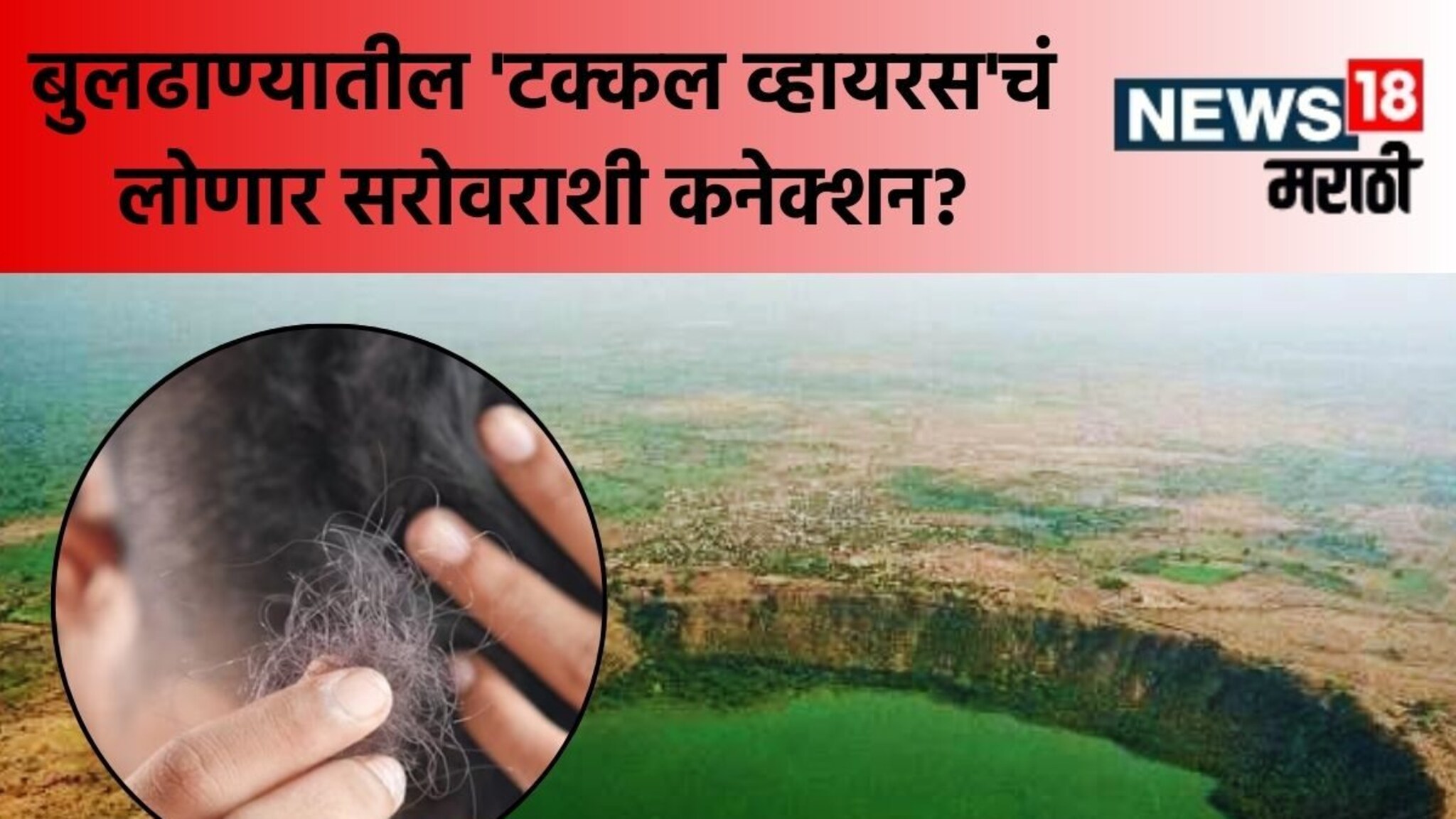 Buldhana News : बुलढाण्यात 'टक्कल व्हायरस'चं थैमान, आजाराचं थेट लोणार सरोवराशी कनेक्शन?