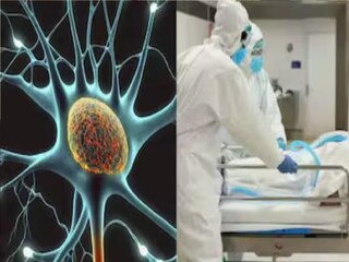 guillain barre syndrome