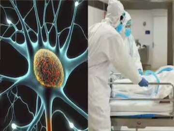 guillain barre syndrome