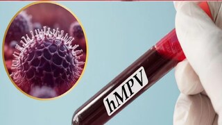 HMPV VIRUS HMPV VIRUS