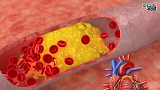 प्रतिकात्मक फोटो : हिवाळ्यात ‘या’ कारणांमुळे वाढतात हार्ट ॲटॅक, आहारात करा ‘हे’ बदल, हृदय राहील फिट आणि निरोगी 