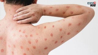 प्रतिकात्मक फोटो : जगासाठी नवी डोकेदुखी, चीनमध्ये नव्या व्हायरसचा प्रकोप प्रतिकात्मक फोटो : जगासाठी नवी डोकेदुखी, चीनमध्ये नव्या व्हायरसचा प्रकोप