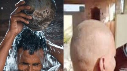 buldhana hair loss buldhana hair loss