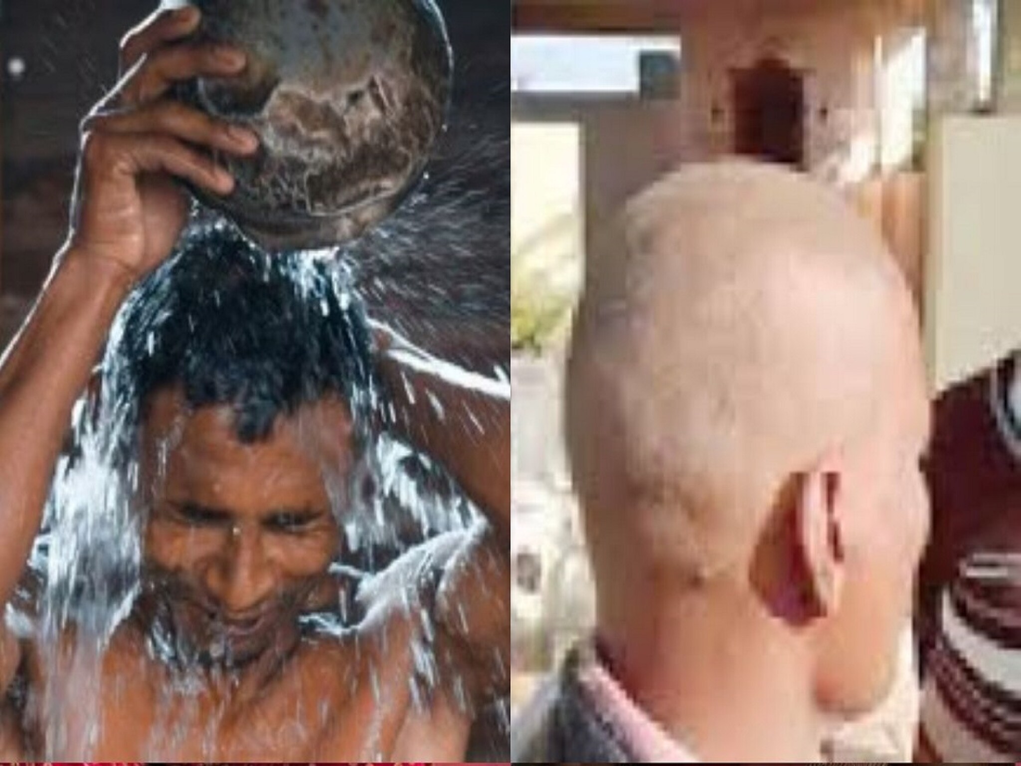 Buldhana : 8 दिवस अंघोळच केली नाही, प्यायच्या पाण्याचं काय? टक्कल व्हायरसनंतर 11 गावांची परिस्थिती काय?