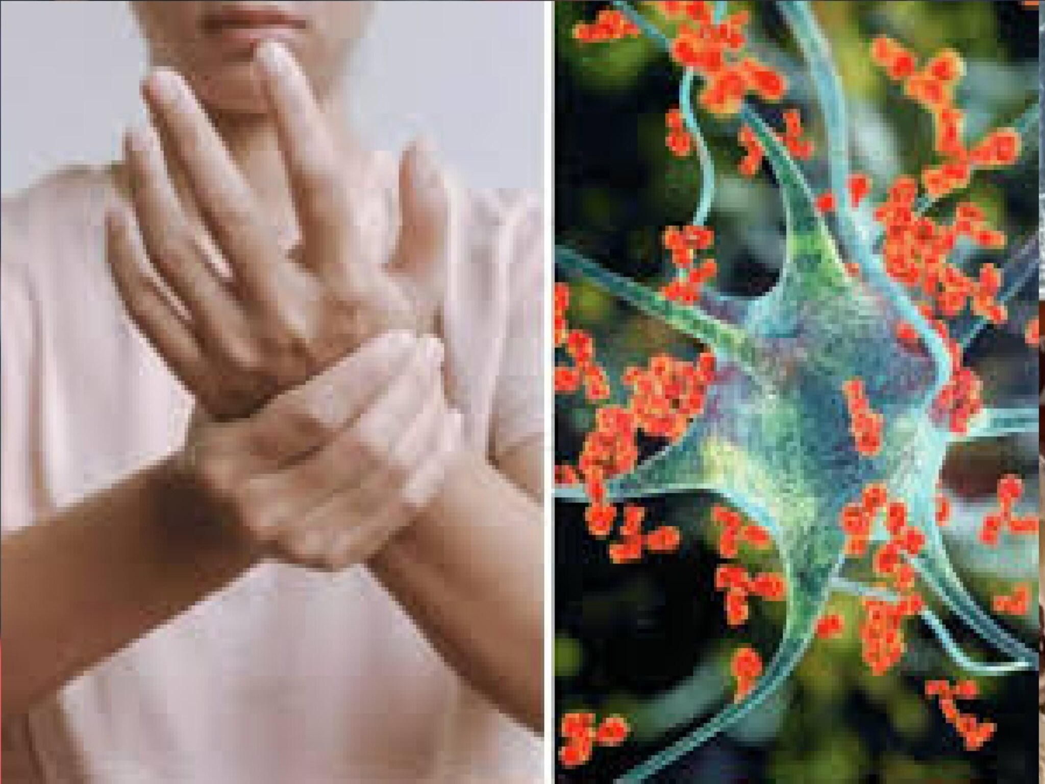 लातूरमध्ये खरंच  GBS शिरकाव झालाय काय? 'त्या' दोन संशयीत रूग्णांचा अहवाल काय?