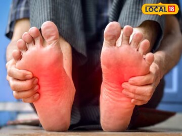 तळव्यांमध्ये होते असह्य जळजळ? करा सोपे उपाय, थंड वाटेल, नसांना आराम मिळेल!