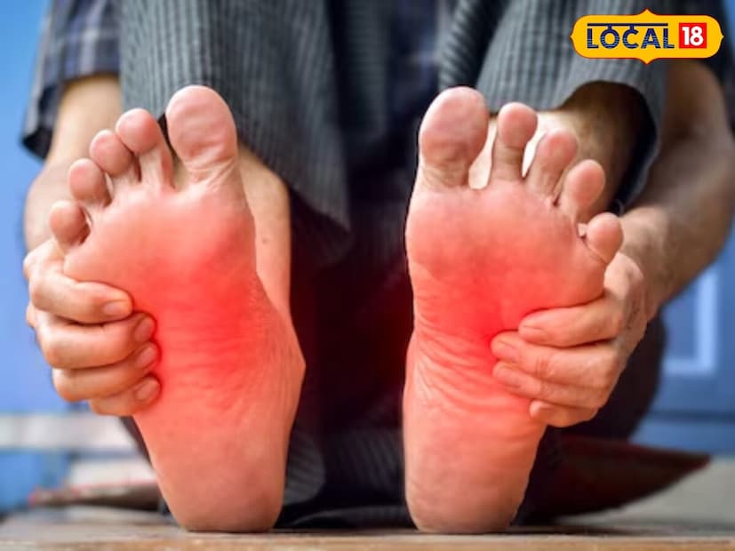 शरीरात व्हिटॅमिन बीची कमतरता असेल, युरिक अ‍ॅसिड वाढलं असेल किंवा डिहायड्रेशन झालं असेल तर तळव्यांमध्ये जळजळ होऊ शकते. आज आपण यावर असे काही उपाय पाहणार आहोत ज्यांमुळे अगदी मूळांपासून आराम मिळू शकेल.  शरीरात व्हिटॅमिन बीची कमतरता असेल, युरिक अ‍ॅसिड वाढलं असेल किंवा डिहायड्रेशन झालं असेल तर तळव्यांमध्ये जळजळ होऊ शकते. आज आपण यावर असे काही उपाय पाहणार आहोत ज्यांमुळे अगदी मूळांपासून आराम मिळू शकेल.