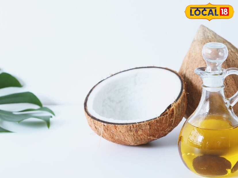 कोरफड गर आणि नारळ औषधी गुणधर्मांनी परिपूर्ण असतं. दोन्ही मिसळून पायांना लावण्याचा सल्ला दिला जातो. यामुळे जळजळ शांत होते आणि थंड वाटतं. कोरफडात असलेल्या अँटी-इफ्लेमेटरी गुणधर्मांमुळे नसांना आराम मिळतो. 