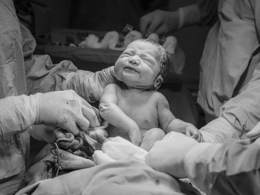 हॉस्पिटलमधला फोटो पाहिल्यावर शबाना जवळ जे बाळ आहे ते साधनाचं आणि साधनाजवळ जे बाळ आहे ते शबानाचं असल्याचं दिसून आलं. (प्रतीकात्मक फोटो)