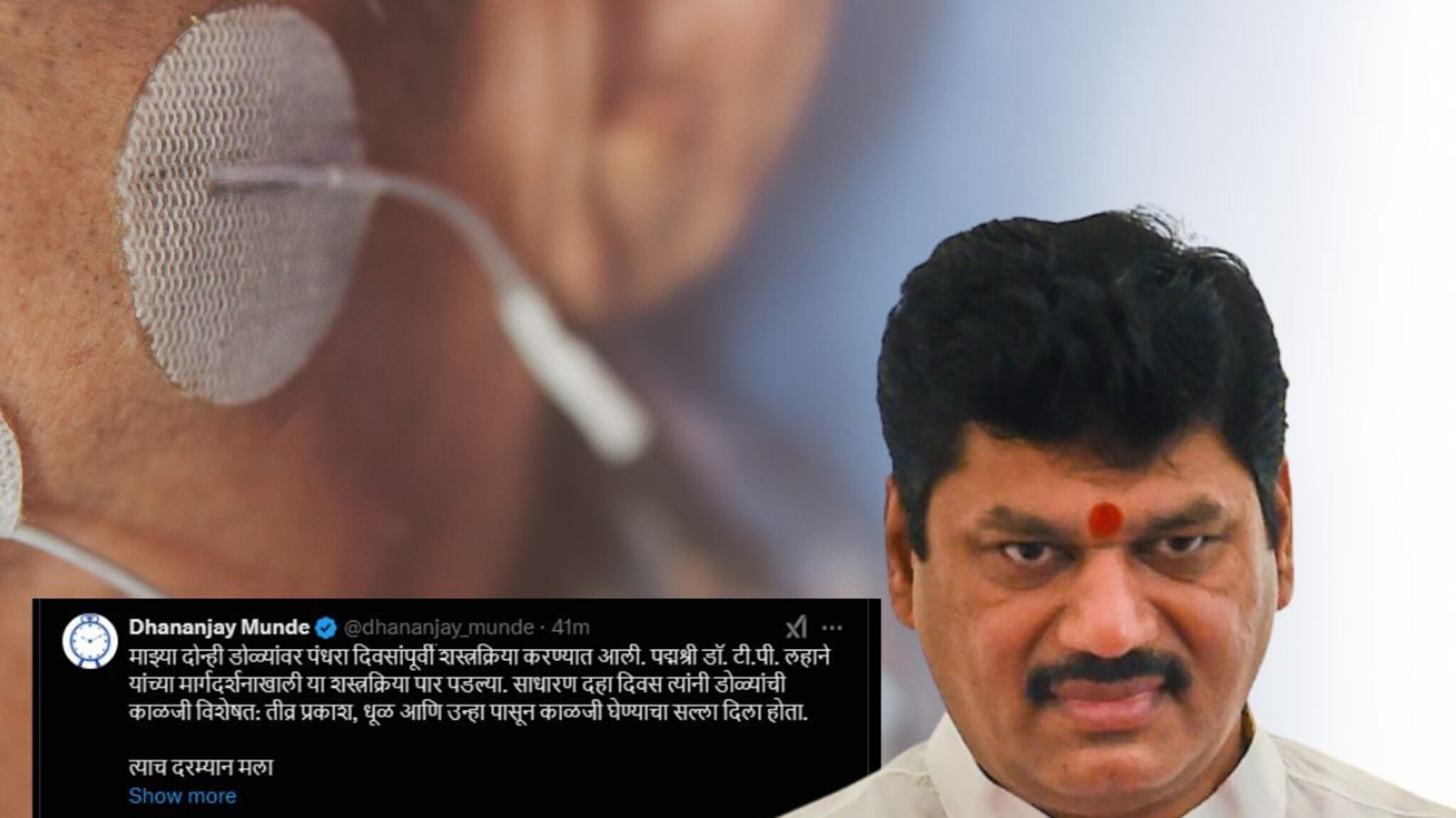 Dhananjay Munde : 'मला 2 मिनिटंही बोलता येईना...'; धनंजय मुंडेंना झालेला दुर्मीळ आजार Bell’s palsy नक्की आहे तरी काय?