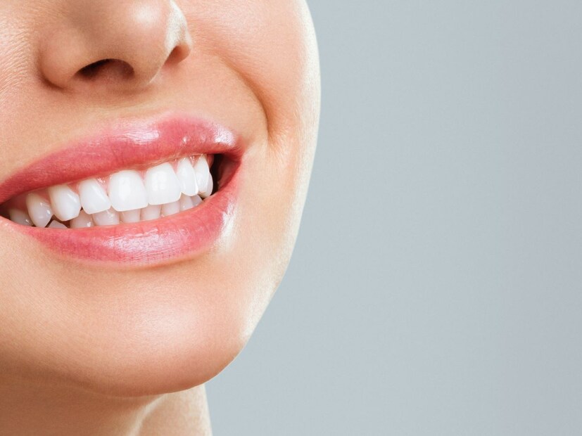 म्हणूनच, नैसर्गिक दातांची योग्य काळजी घ्या! योग्य आहार घ्या, ब्रश करा आणि डेंटिस्टकडे नियमित तपासणीसाठी जा.