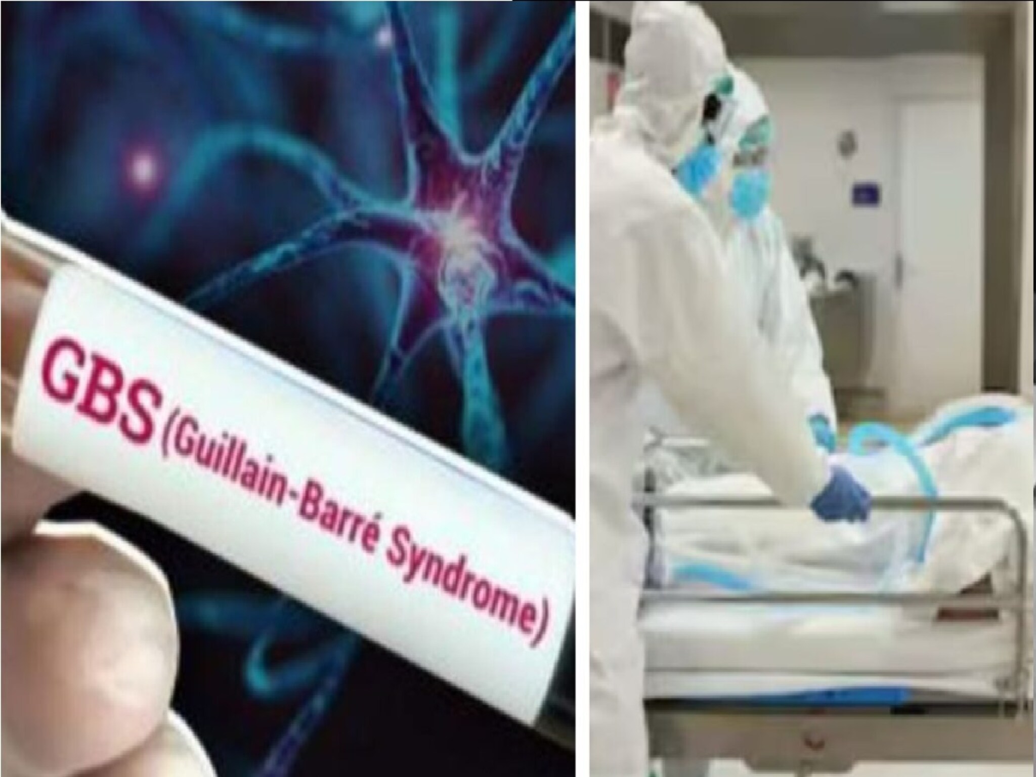 GBSने धोक्याची रेषा ओलांडली!पुणे,मुंबईनंतर या जिल्ह्यात 24 तासात सापडले दोन बळी