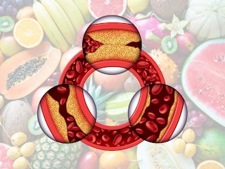 Best fruits for cholesterol Best fruits for cholesterol