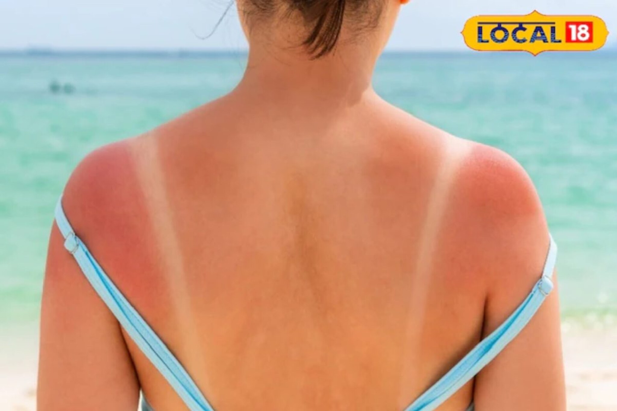 उन्हात फिरून रापलात? पार्लरची गरज नाही, घरीच मिळवा सुपर नॅचरल ग्लो!