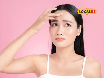 उन्हाळ्यात तेलकट त्वचेमुळे त्रस्त आहात? ‘हे’ करा लगेच उपाय, चेहरा राहील फ्रेश