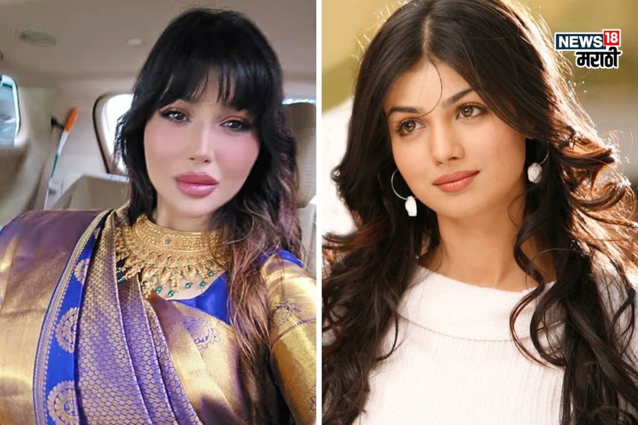 सर्जरीमुळे अभिनेत्रीची वाईट अवस्था, ट्रोलिंगनंतर झाली गायब, आता काय करतेय आयशा?