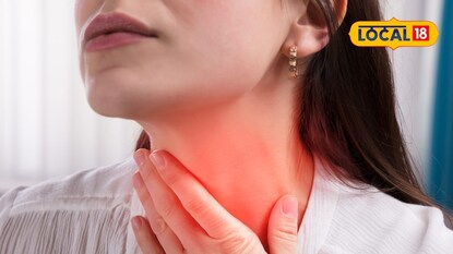 Sore throat in summer