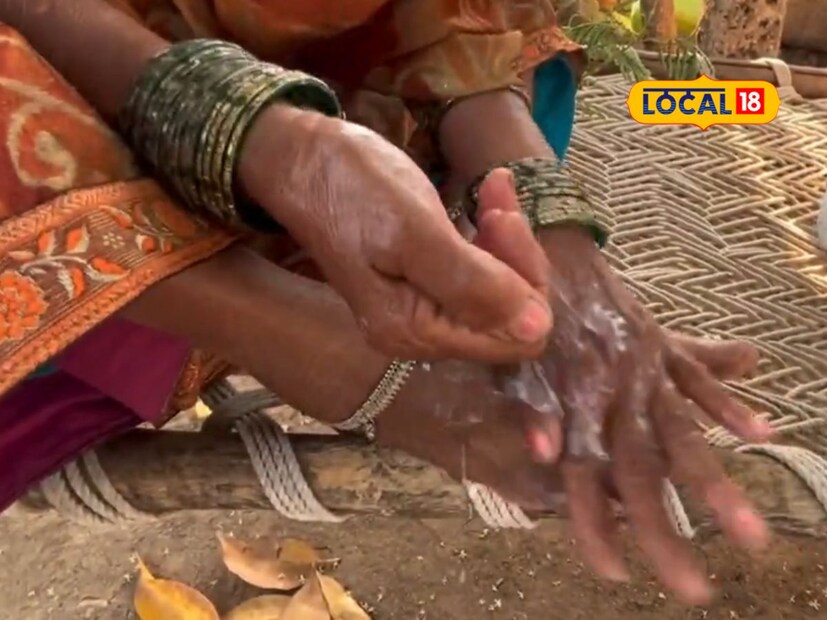 हा उपाय केवळ लहान बाळांसाठीच नव्हे तर सर्व वयोगटांच्या महिला आणि पुरुषांसाठी उपयुक्त ठरतो. बकरीचे दूध तळपाय, तळहाताने लावल्यानंतर हातांना, पायांना थंडावा मिळतो. तसेच शरीरातील उष्णता कमी होऊन उन्हाळीच्या त्रासापासून सुटका मिळण्यास मदत होते. साधारणपणे 15 ते 20 मिनिटांमध्ये उन्हाळी लागलेल्या व्यक्तीला बकरीच्या दुधाने परिणाम जाणवतो, असं जाणकार विठ्ठल काळे यांनी सांगितलं.