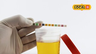 urine color meaning urine color meaning
