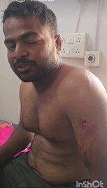बिबट्याच्या हल्ल्यात नखांचे खोलवर वार, दंडावर ओरखडे, पण स्टील बॉडीमुळे जीव वाचला बिबट्याच्या हल्ल्यात नखांचे खोलवर वार, दंडावर ओरखडे, पण स्टील बॉडीमुळे जीव वाचला