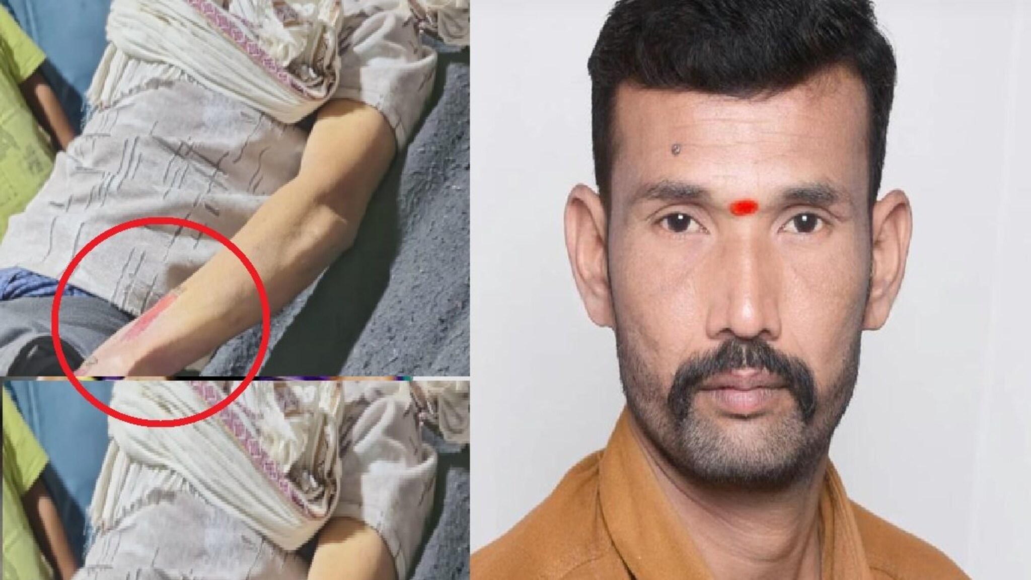 भाजप आमदाराच्या निकटवर्तीय पदाधिकाऱ्याचा मृतदेह संशयास्पदरित्या आढळला, अंगावर जखमा