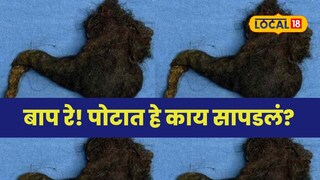 Hair ball in stomach Hair ball in stomach