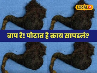 Hair ball in stomach