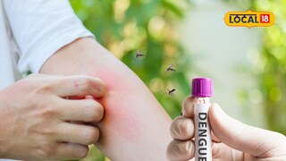 Dengue symptoms and remedies :