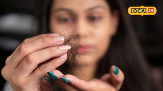 Monsoon hair fall remedies