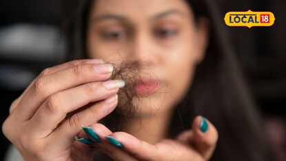 Monsoon hair fall remedies Monsoon hair fall remedies