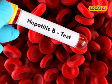 Blood Group Blood Group