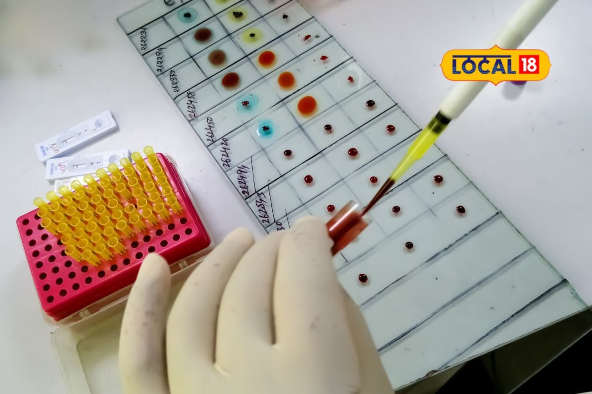 लग्न जुळवताना रक्तगट बघणं का गरजेचं? सारखा असल्यावर काय होतात परिणाम? Video