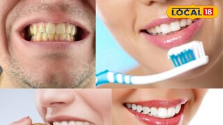 जीवनसत्त्वांची कमतरता आणि दातांचे आरोग्य जीवनसत्त्वांची कमतरता आणि दातांचे आरोग्य