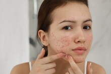 Skin Care : महागड्या क्रिम्सची गरज नाही, या सोप्या टिप्सनं चेहरा होईल स्वच्छ