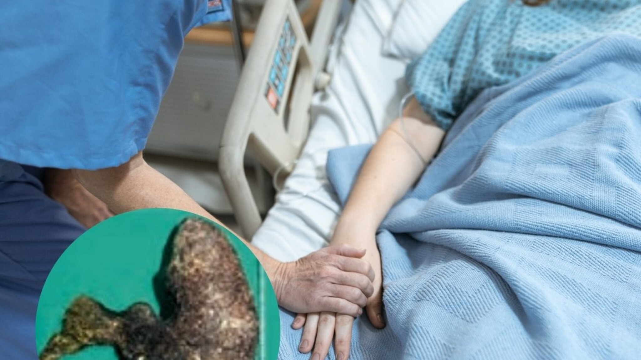 10 वर्षीय मुलीच्या पोटातून निघाले अर्धा किलो केस; पालकांसह डाॅक्टरही चकित!