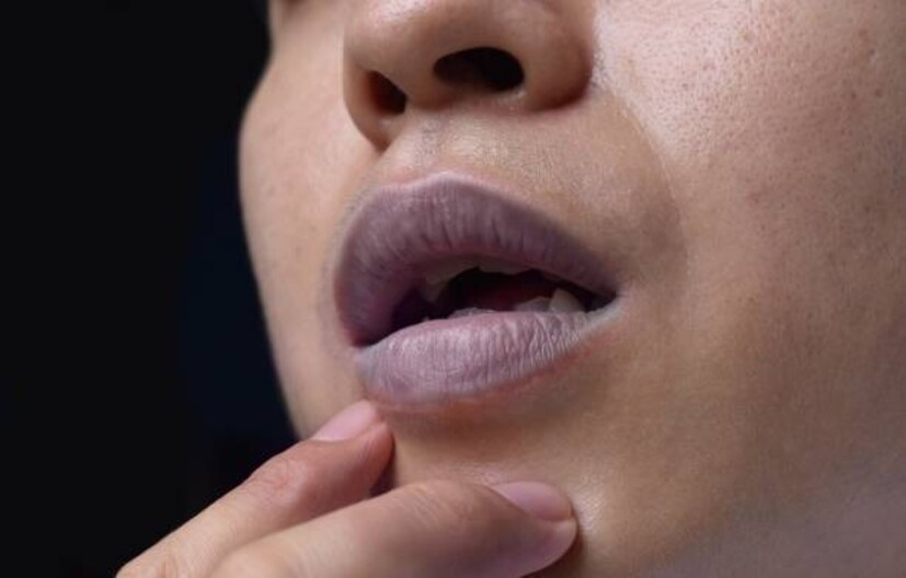 निळे ओठ: जर एखाद्याचे ओठ अचानक निळे दिसू लागले तर ते हृदयरोग किंवा फुफ्फुसांच्या समस्येचे कारण असू शकते. जेव्हा हृदय किंवा फुफ्फुसे योग्यरीत्या कार्य करत नाहीत तेव्हा शरीरात ऑक्सिजनची कमतरता जाणवते आणि कार्बन डायऑक्साइड वाढते त्यामुळे ओठ निळे दिसू लागतात. जे आरोग्यासाठी धोकादायक असू शकते.