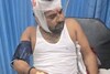ओबीसी नेते लक्ष्मण हाकेंच्या सहकाऱ्यावर बीडमध्ये हल्ला, लाठ्या-काठ्यांनी मारहाण